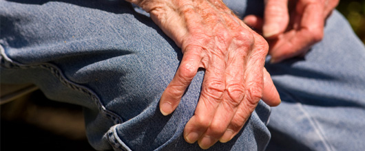 Parkinson